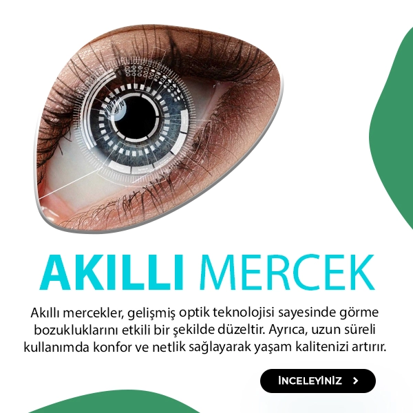 Akıllı Mercek
