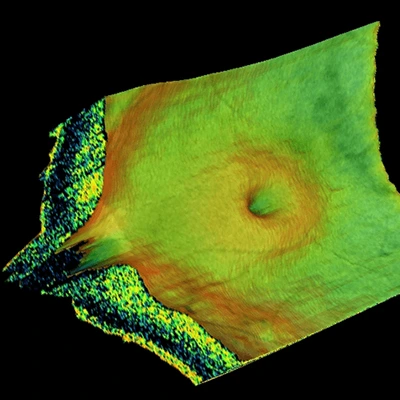 Optik Kohorens Tomografisi (OCT)